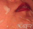 VRTM-045